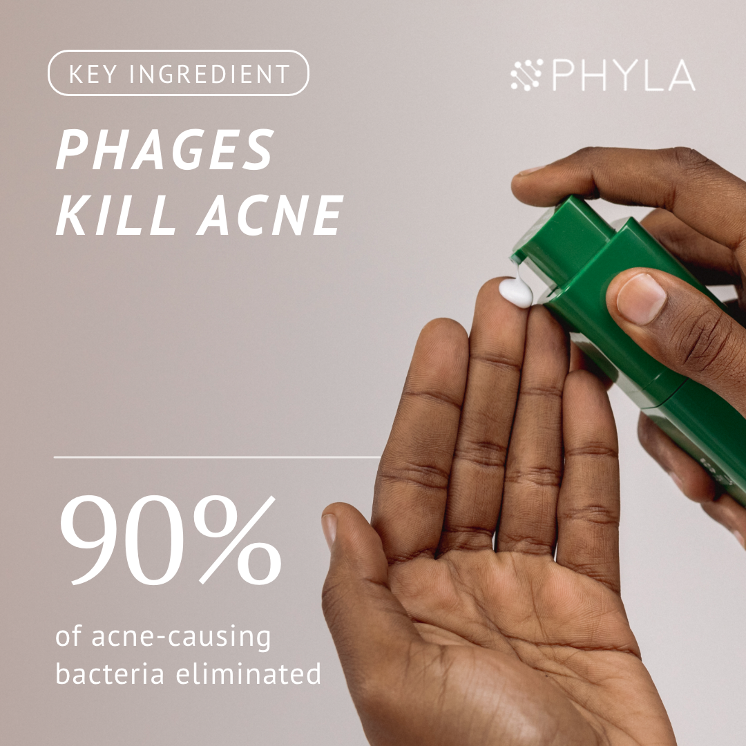 Acne-Fighting Phage System (60 Day Supply) OOMLA