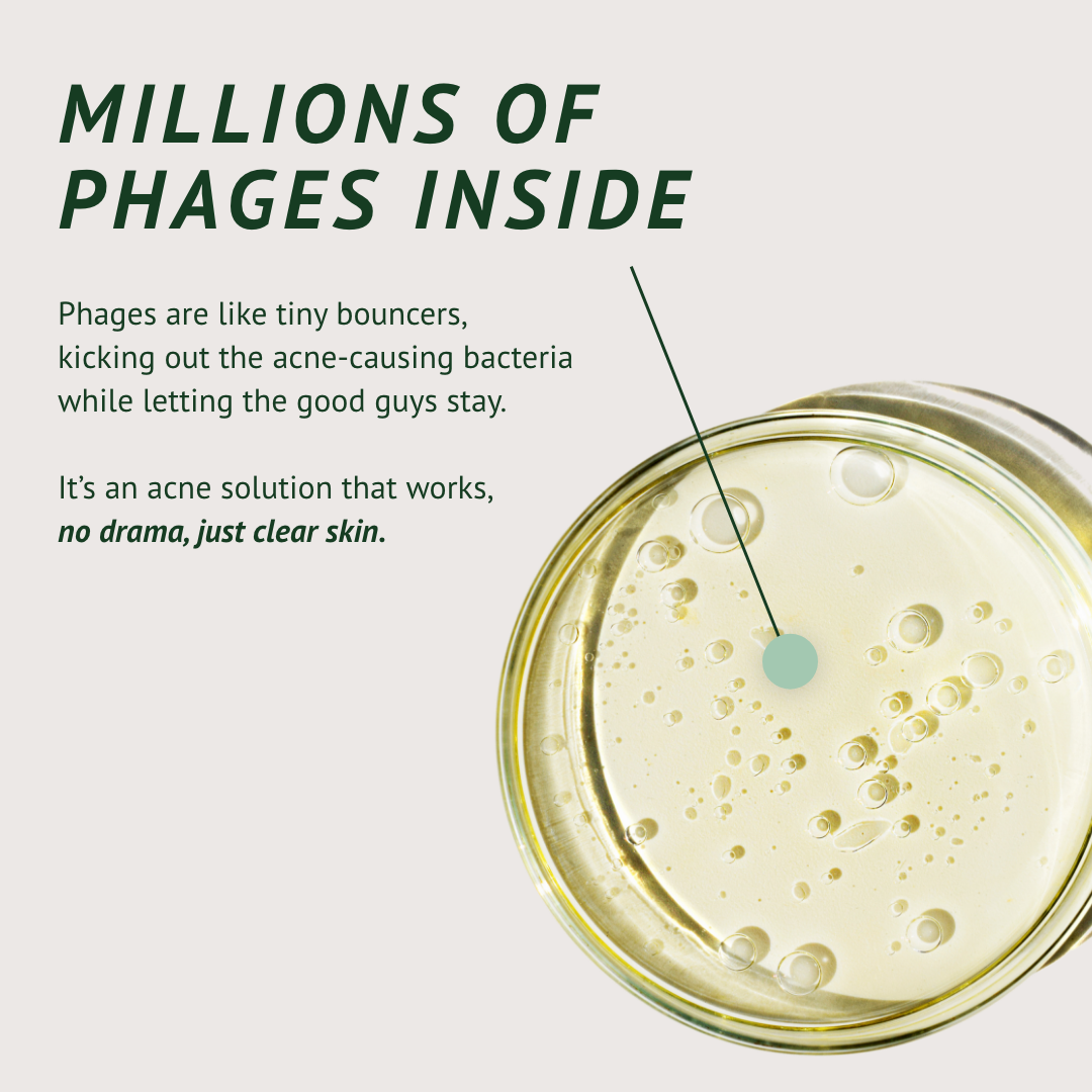 Acne-Fighting Phage System (60 Day Supply) OOMLA